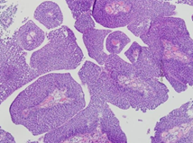 Picture of Foundation Models for Ewing Sarcoma
