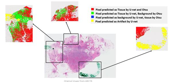Project Deep Learning Approach for Tissue Segmentation in Whole Slide Images Picture 1