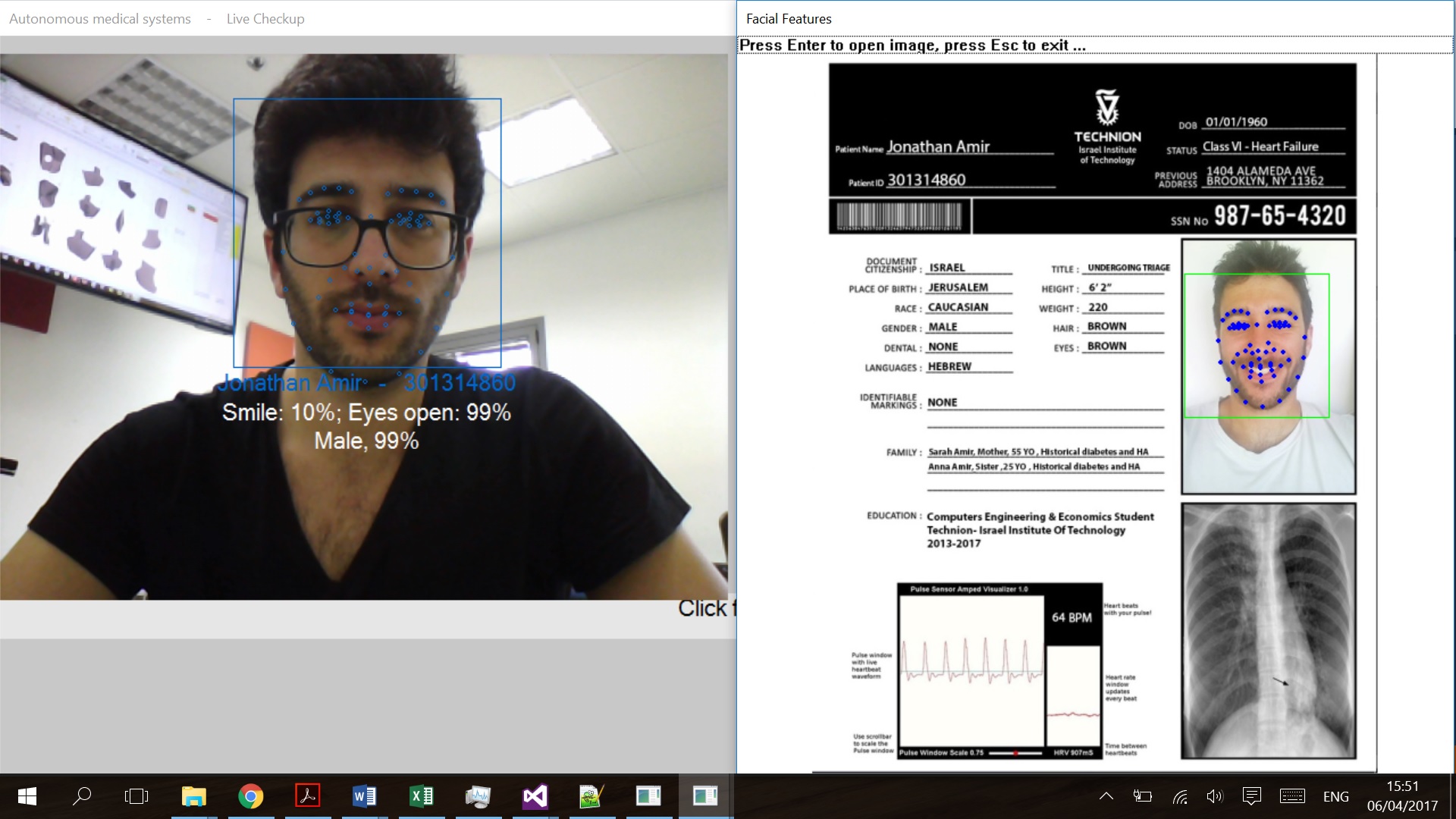 Project RGB camera based heart-rate estimation using Eulerian Video Magnification (EVM) Picture 4