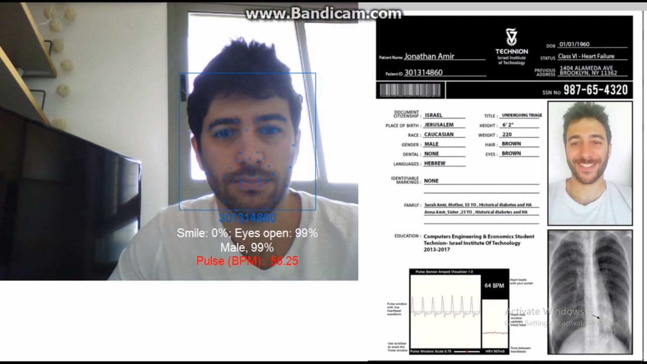 Project RGB camera based heart-rate estimation using Eulerian Video Magnification (EVM) Picture 5