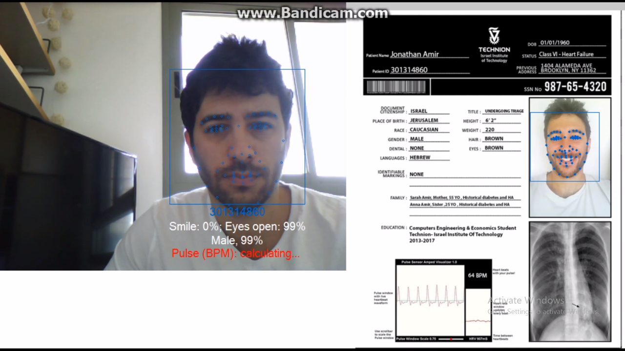 Project RGB camera based heart-rate estimation using Eulerian Video Magnification (EVM) Picture 6